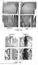 Fig. 06 - Pharmaceutical compositions for treating or preventing bone conditions