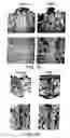 Fig. 07 - Pharmaceutical compositions for treating or preventing bone conditions