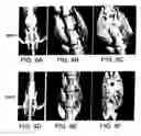 Fig. 09 - Pharmaceutical compositions for treating or preventing bone conditions