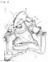 Fig. 06 - Occlusal plane analyzer, articulator, and occlusal plane analyzing method