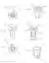 Fig. 04 - Refractory model system an indirect system for capturing tooth and/or dental implant shapes and relative positions utilizing pre-fabricated  parts and refractory cements