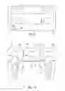 Fig. 06 - Method for designing a plurality of adjacent tooth restorations using CAD/CAM technology