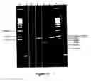 Fig. 09 - Method for Preparing Polynucleotides for Analysis