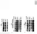Fig. 09 - Compositions and methods for diagnosing tumors using LEDGF/p75