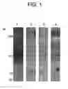Fig. 02 - Determination of AM-binding proteins and the association of adrenomedullin (AM) therewith