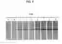 Fig. 04 - Determination of AM-binding proteins and the association of adrenomedullin (AM) therewith