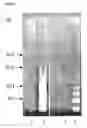 Fig. 06 - AGGLUTINATION-BASED METHOD FOR FAST DETECTION, ISOLATION AND QUANTIFICATION OF APOPTOTIC CELLS