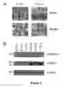 Fig. 04 - Snapin and methods for regulation of microtubule assembly and dendrite growth and branching