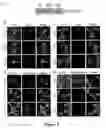 Fig. 06 - Snapin and methods for regulation of microtubule assembly and dendrite growth and branching