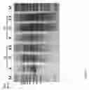 Fig. 02 - EXPRESSION OF AN ACTIVE CARRIER FROM XYLOSE IN GENETICALLY MODIFIED SACCHAROMYCES CEREVISAE