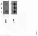 Fig. 04 - EXPRESSION OF AN ACTIVE CARRIER FROM XYLOSE IN GENETICALLY MODIFIED SACCHAROMYCES CEREVISAE