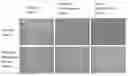 Fig. 01 - MUSCULAR DYSTROPHY DRUG