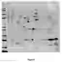 Fig. 06 - HEMOGLOBIN-BASED METHODS FOR PROPHYLAXIS, DIAGNOSIS AND/OR TREATMENT OF RETINAL DISORDERS
