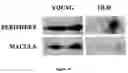 Fig. 11 - HEMOGLOBIN-BASED METHODS FOR PROPHYLAXIS, DIAGNOSIS AND/OR TREATMENT OF RETINAL DISORDERS