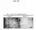 Fig. 04 - METHODS FOR INDUCING COMPLETE APOPTOSIS OF LIVER CELLS EXPRESSING HBCHI PROTEIN AND SCREENING FOR SUBSTANCES OR GENES THAT INHIBIT THE APOPTOSIS