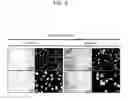 Fig. 05 - METHODS FOR INDUCING COMPLETE APOPTOSIS OF LIVER CELLS EXPRESSING HBCHI PROTEIN AND SCREENING FOR SUBSTANCES OR GENES THAT INHIBIT THE APOPTOSIS