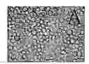 Fig. 01 - Method of making and administering quinoline derivatives as anti-cancer agents