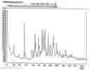Fig. 01 - POLYMORPHIC FORM XVI OF FEXOFENADINE HYDROCHLORIDE
