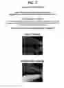 Fig. 08 - METHODS FOR ATTAINING ENHANCED SEXUAL WELLNESS USING ANHYDROUS COMPOSITIONS