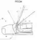 Fig. 17 - Endoscope