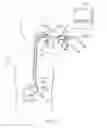 Fig. 05 - Manipulatable guide system and methods for natural orifice translumenal endoscopic surgery