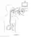 Fig. 07 - Manipulatable guide system and methods for natural orifice translumenal endoscopic surgery