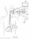 Fig. 08 - Manipulatable guide system and methods for natural orifice translumenal endoscopic surgery
