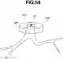 Fig. 40 - Endoscope insertion support system and endoscope insertion support method
