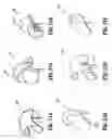 Fig. 33 - Endoscopic surgical devices
