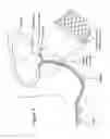 Fig. 06 - Catheter for Enhanced Image Location Detection