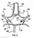 Fig. 06 - Method and system for evaluation of the hemodynamic model in depression for diagnosis and treatment