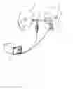 Fig. 01 - Method and Arrangement for Generating a Signal which Corresponds to the Degree of Opening of the Vocal Folds of the Larynx