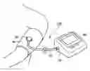 Fig. 01 - BLOOD-PRESSURE MEASURING DEVICE