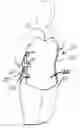 Fig. 01 - SPINAL ORTHOSES