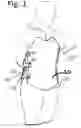 Fig. 02 - SPINAL ORTHOSES