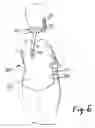 Fig. 07 - SPINAL ORTHOSES