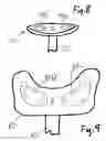 Fig. 09 - SPINAL ORTHOSES