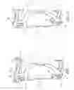 Fig. 02 - Orthopedic or prosthetic support device