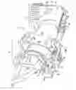 Fig. 02 - STATIC PROGRESSIVE PRONATION SUPINATION SPLINT
