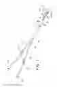 Fig. 02 - Multi-lumen catheter assembly