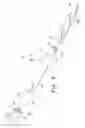 Fig. 06 - Winged catheter assembly