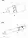 Fig. 06 - Administration apparatus for medical use