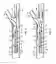 Fig. 04 - Method and Apparatus for Treating Stenoses at Bifurcated Regions