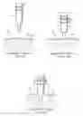 Fig. 04 - System and method for providing an obturator for enhanced directional capabilities in a vascular environment