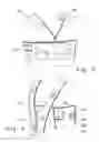Fig. 03 - MEDICAL GARMENT WRAP