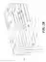 Fig. 04 - NEEDLE DEVICE HAVING SLIDEABLE MEMBER PROVIDING ENHANCED SAFETY