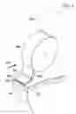 Fig. 04 - Reduced-pressure system and method employing a gasket