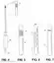 Fig. 04 - Uterine therapy device and method