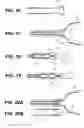 Fig. 07 - Uterine therapy device and method