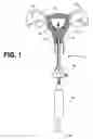 Fig. 02 - Uterine therapy device and method